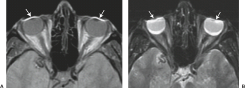 mri.png mri.png